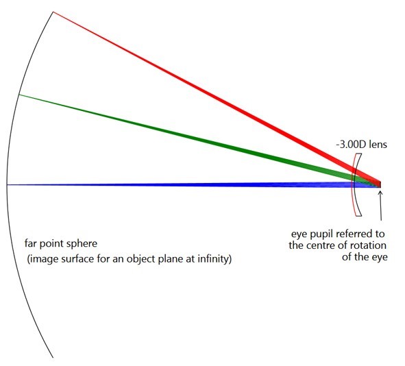 Ansys Zemax光学设计软件技术教程：眼科鏡片設計的图1