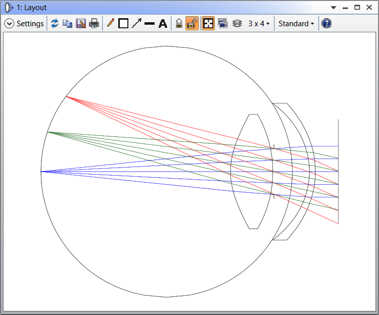 the Eye_Retinal Object model