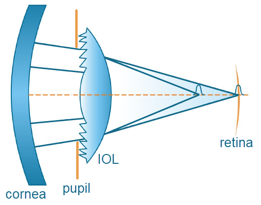 DiffrIOLmodel_rev.bmp